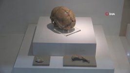 Dünyanın ilk beyin ameliyatı 10 bin 500 yıl önce Aksaray'da yapıldı
